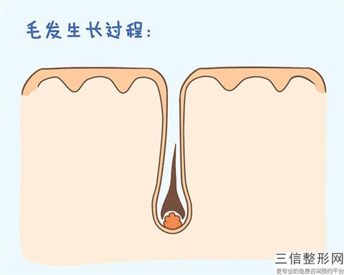 郑州市微晶磨削治疗医生排名前十名发布-胡向东医生正规专家推荐给你