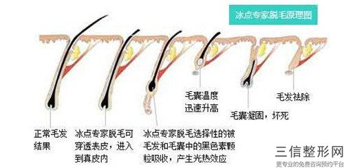 娄底爱思特医疗整形美容医院怎么样-收费明细已发布