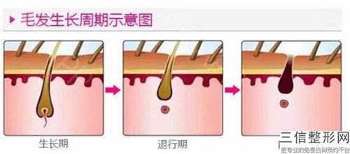 杭州市阴部脱毛价位表热门项目爆出(阴部脱毛手术价格大概多少)