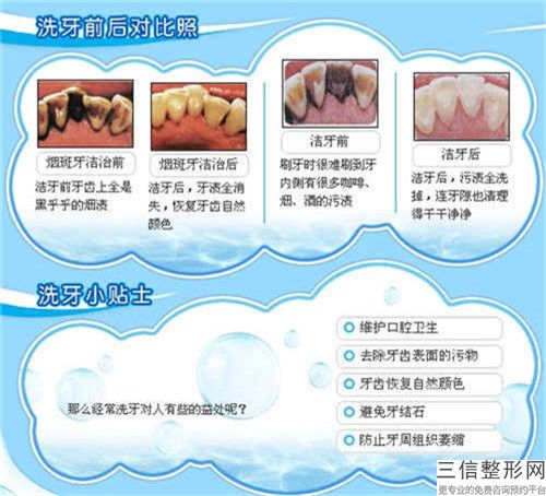 荆州市全口牙齿美白价位表信息公示-荆州市全口牙齿美白价格